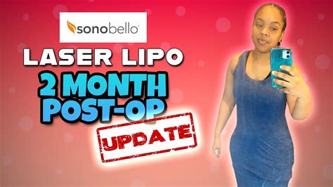 Laser Lipo at Sono Bello